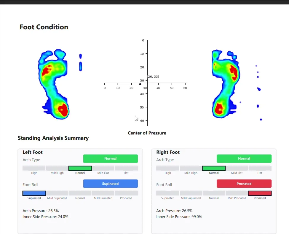 Standing Test report showing arch type and foot roll classification with pressure map